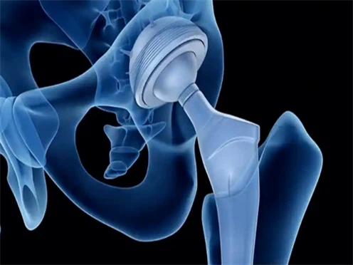 nitinol sheet nitinol sheet